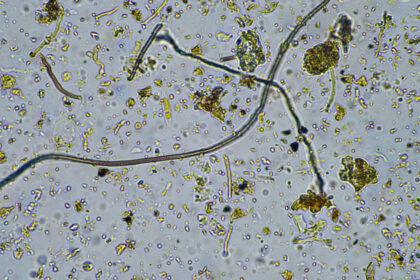 o ciuperca rara care ataca creierul se raspandeste in sua infectia poate ucide pana la 70 dintre pacienti 6ad37dc42b9e2