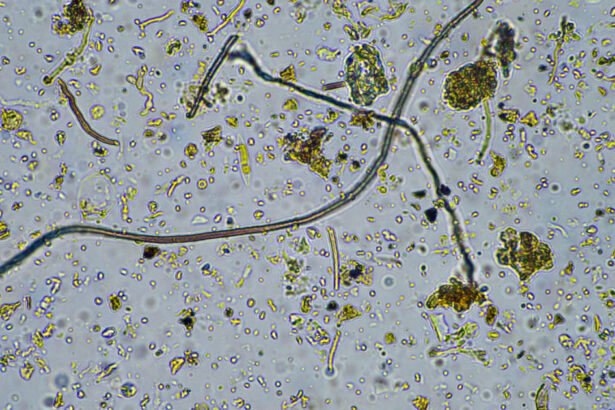 o ciuperca rara care ataca creierul se raspandeste in sua infectia poate ucide pana la 70 dintre pacienti 6ad37dc42b9e2