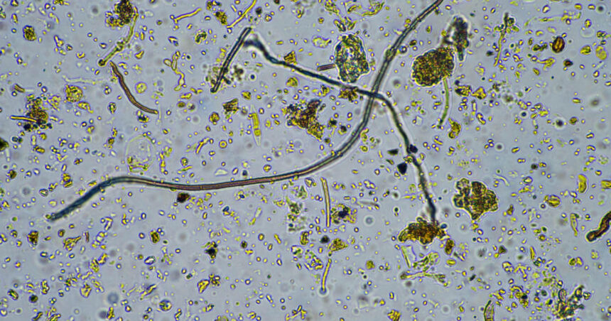 o ciuperca rara care ataca creierul se raspandeste in sua infectia poate ucide pana la 70 dintre pacienti 6ad37dc42b9e2
